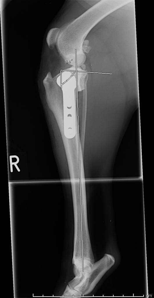 Synthes Tplo Chart