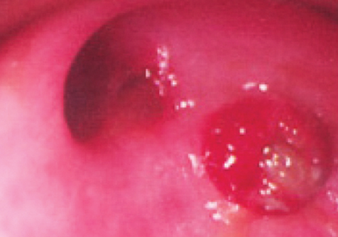 1321 - Practical Endoscopy