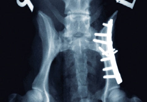 pelvic fracture course