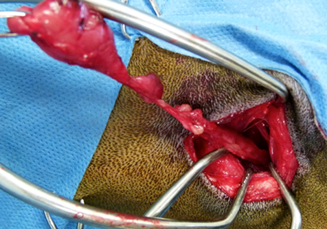 2015-Soft-Tissue-Surgery-for-APs