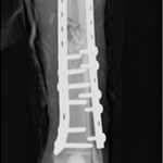 fracture masterclass for small animal orthopaedic surgeons