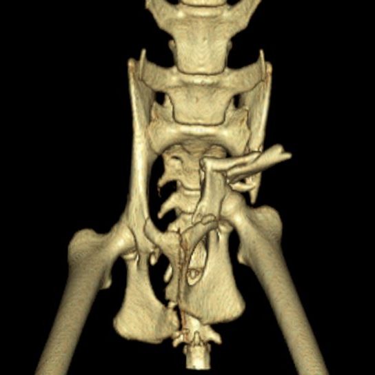 pelvic fracture management