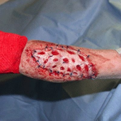 wound management and closure for veterinary surgeons